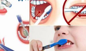 Đánh răng thế nào để tránh sâu răng?